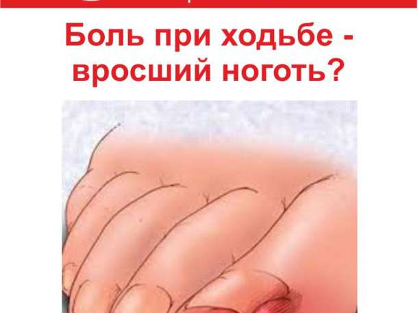 Профилактика сахарного диабета в Алматы, фотография 4