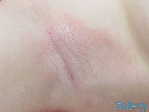 Шугаринг/Депиляция М/Ж, фотография 1