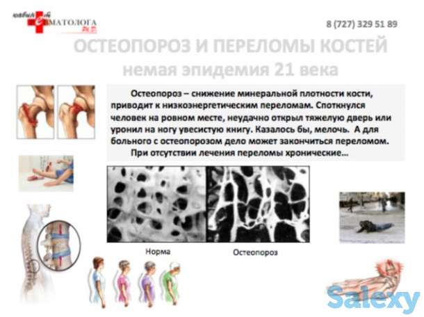 Консультация ревматолога к.м.н. Ph.D. , терапевта высшей категории, 30 летний стаж работы., фотография 4