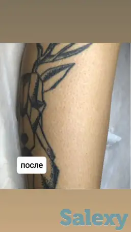 Шугаринг, фотография 4