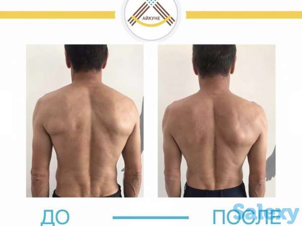 Оздоровительный центр «Айкуне», фотография 6