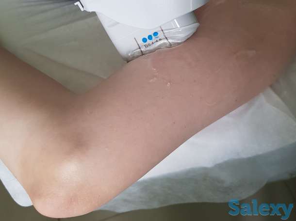 Кавитация, фотография 6