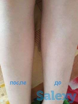 Шугаринг, фотография 3