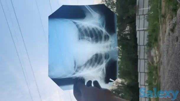 Куплю рентген плёнку, фотография 1