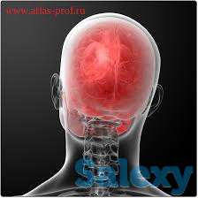 правка атланта, фотография 1