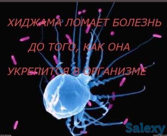 Хиджама, фотография 1