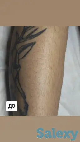 Шугаринг, фотография 3