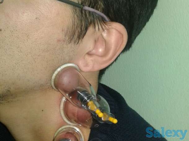 Хиджама, фотография 2