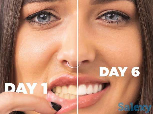 Отбеливание для зубов Happy Smile, фотография 6