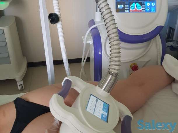 Криолиполиз, фотография 3