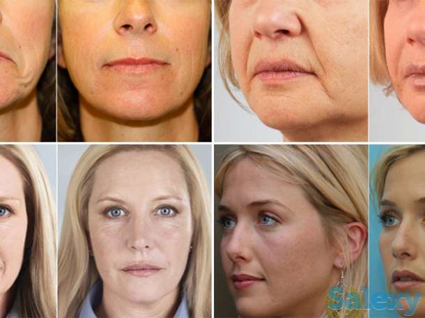 Ищем дистрибьютора в вашем городе, фотография 4