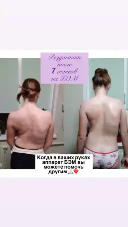 Органы под защитой биоэнергии., фотография 6