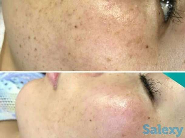 Инновация! BB glou! (тональный крем на год), фотография 8