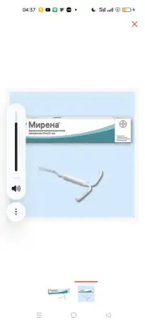 Спираль Мирена, фотография 1