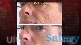 Лифтинг-крем Ultimate Young BeautyLine, фотография 3