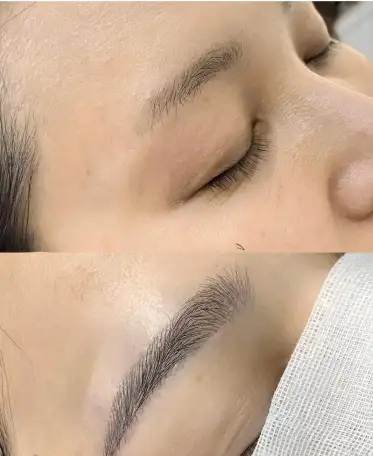 Станьте мастером пересадки бороды, фотография 1