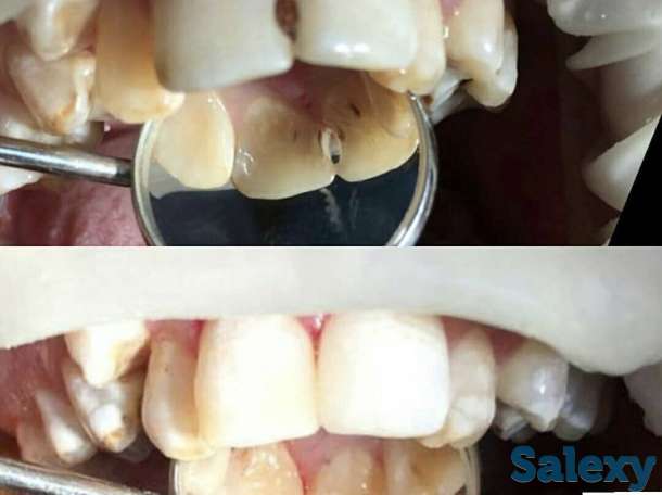 Стоматология доктора Изимова, фотография 2