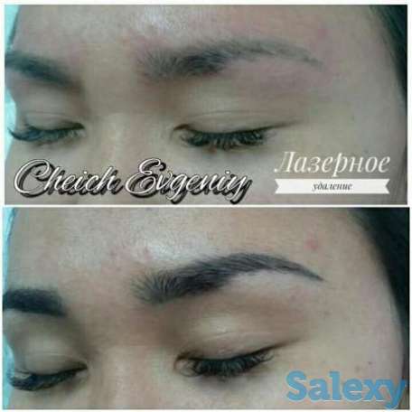 Удаление тату и татуажа, фотография 1