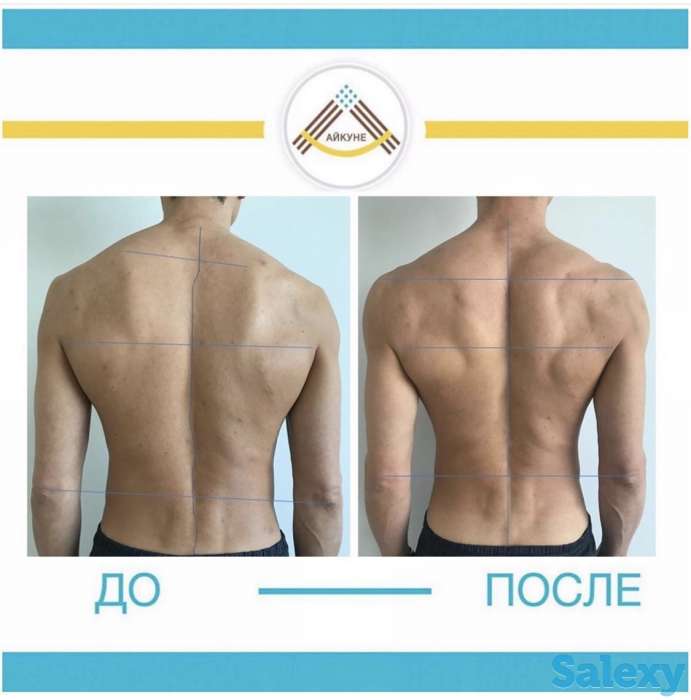 Оздоровительный центр «Айкуне», фотография 8