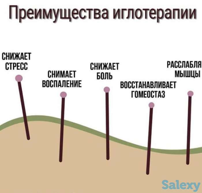 Аккурунктурная пластика лица, фотография 3
