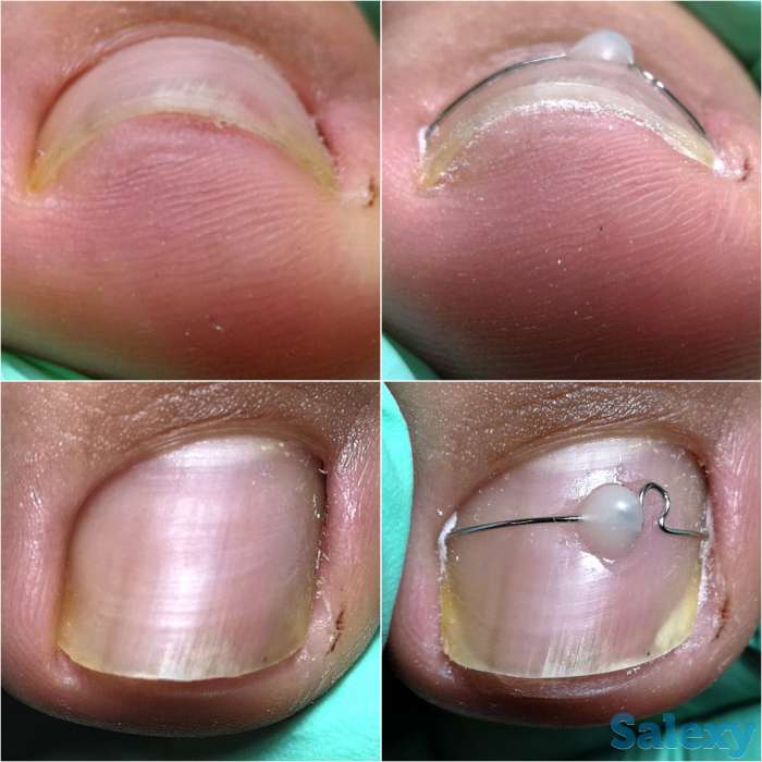 Ноги - наше всё, фотография 6