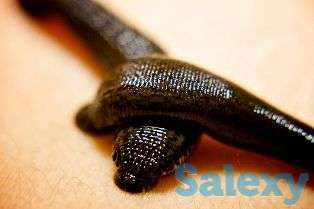 Лечение пиявками, фотография 1