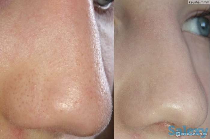 Инновация! BB glou! (тональный крем на год), фотография 4