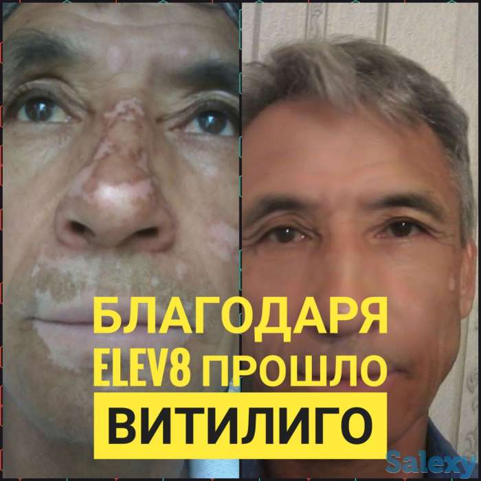 Здоровье и бизнес с продуктом правильного клеточного питания ELEV8 компании BEPIC, фотография 4