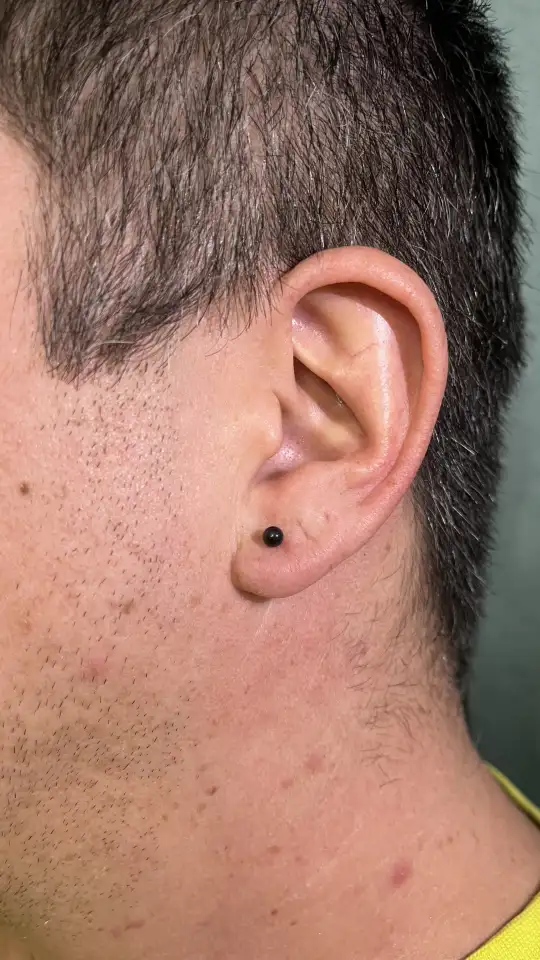 Прокол ушей детям и взрослым, фотография 16