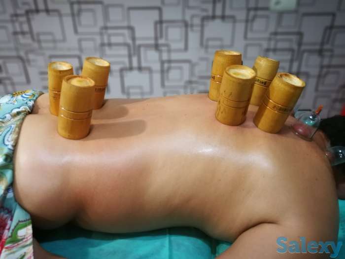 Иглотерапия, массаж, Хиджама, ЛФК, лечение огнём, баночный массаж, фотография 6