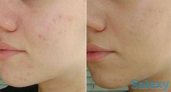 Инновация! BB glou! (тональный крем на год), фотография 3