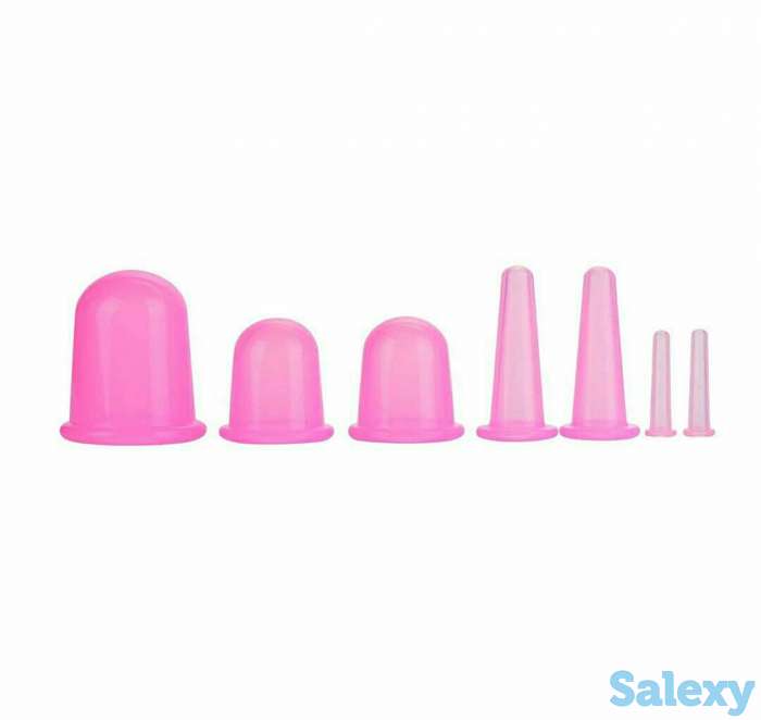 Вакуумные банки г. Усть-Каменогорск, фотография 2