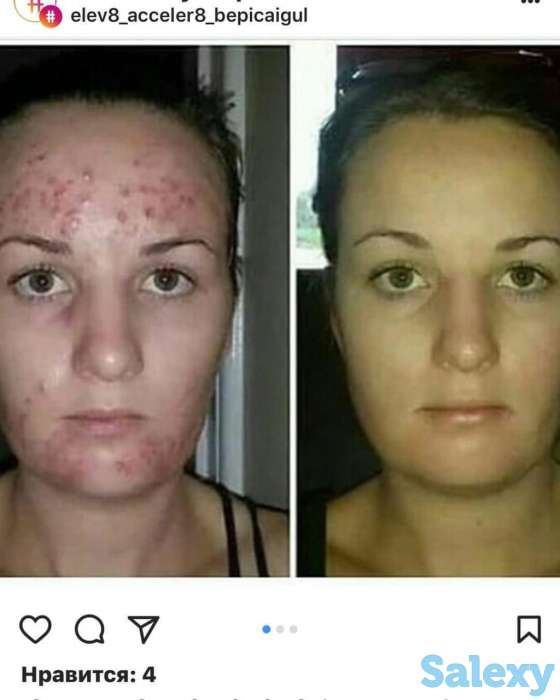 Здоровье и бизнес с продуктом правильного клеточного питания ELEV8 компании BEPIC, фотография 2