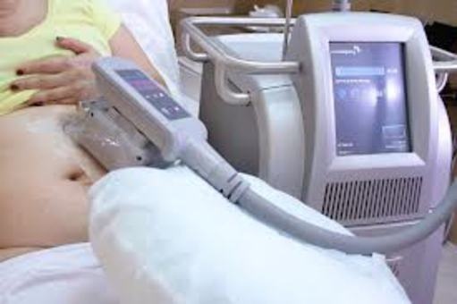 КРИОЛЕПОЛЕЗ-Липосакция замораживанием - новый высокоэффективный метод., фотография 1