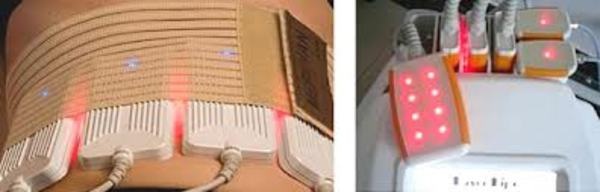 Липолазер. Скульптурирование без скальпеля, фотография 1