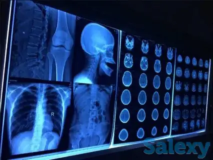 Рентген Плёнка - Утилизация Покупка, фотография 1