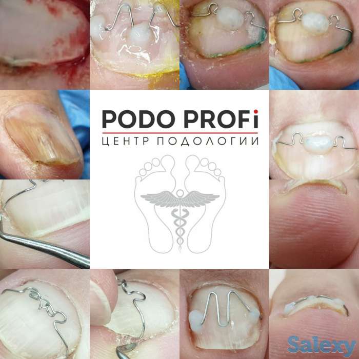 Ноги - наше всё, фотография 1