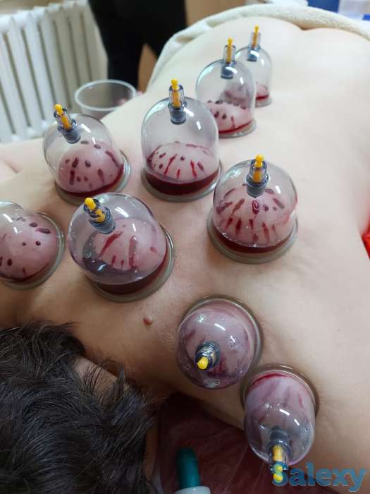 Хиджама, фотография 2