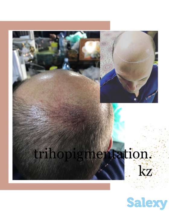 Трихопигментация головы в Алматы, фотография 6