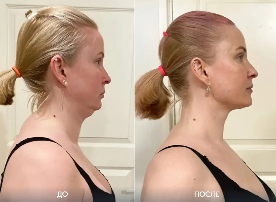 Продам натуральный нефритовый камень для омоложения лица, фотография 4