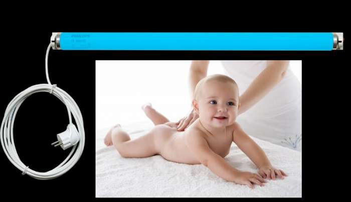 Фотолампа от желтухки у новорожденных., фотография 1