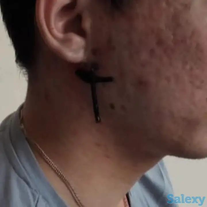 Пиявки ставим одноразовые. Очистка, омоложение , лечениеОчень много пользы., фотография 6