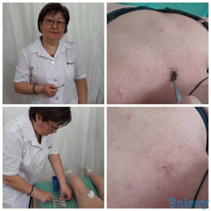 Лечение пчелами в Алматы, фотография 1