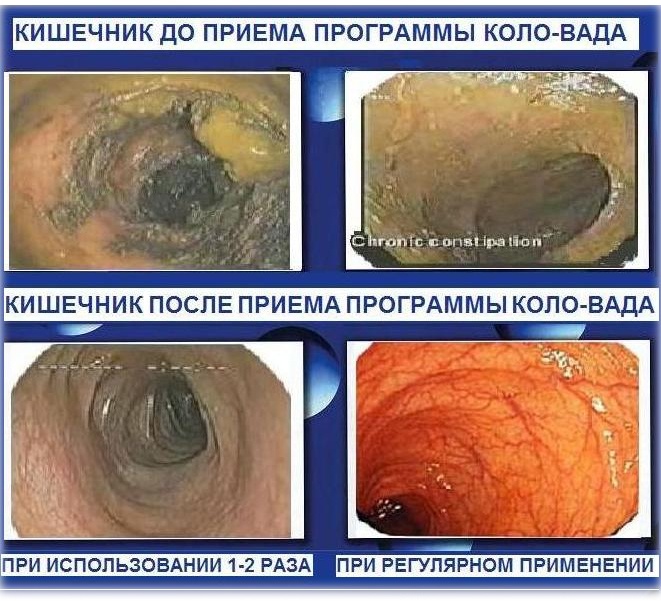 Худеем и очищаем организма комфортно, правильно и безопасно в домашних условиях, фотография 6