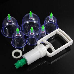 Хиджама для Женщин в Нурсултан!, фотография 1