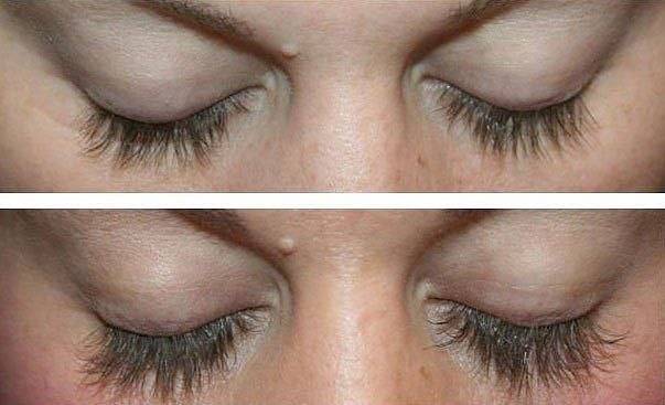 Lurey Lash MD- уникальная американская сыворотка для роста ресниц и бровей, фотография 1