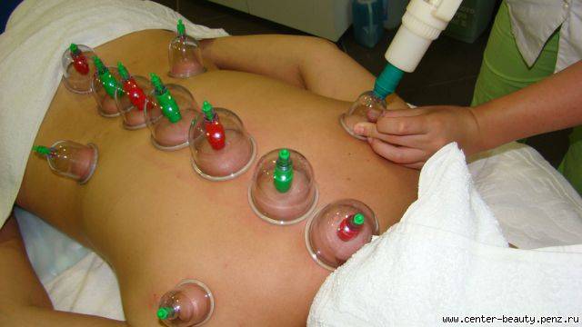 хиджама в астане, фотография 1