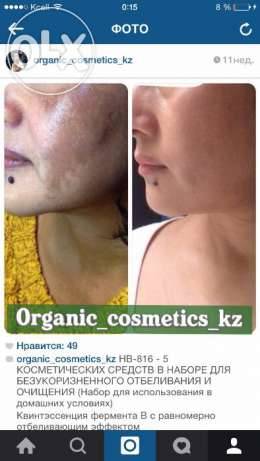 Бесплатная диагностика кожи лица, фотография 2