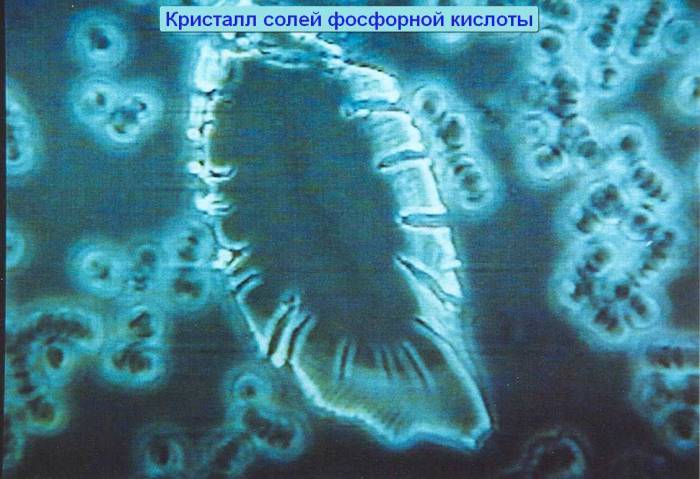 Новейшая диагностика крови, фотография 2