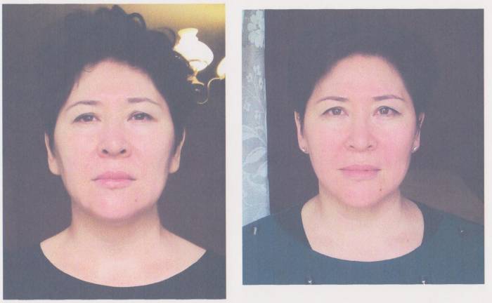 Лицо. Лифтинг. Эстетическое мануальное моделирование лица., фотография 2